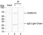 Coronin 3 Antibody in Immunoprecipitation (IP)