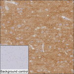 Spectrin beta-3 Recombinant Mouse Monoclonal Antibody (K29098_2H8)