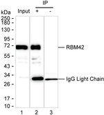 RBM42 Antibody in Immunoprecipitation (IP)