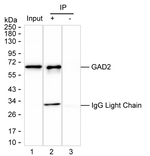 GAD65 Recombinant Mouse Monoclonal Antibody (K92083_20C11)