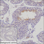 SPATA24 Recombinant Mouse Monoclonal Antibody (K92087_8G1)