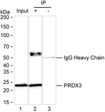 PRDX3 Recombinant Mouse Monoclonal Antibody (K94080_17G4)