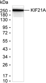 KIF21A Recombinant Mouse Monoclonal Antibody (K40101_13B4)
