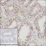 NIPA Recombinant Mouse Monoclonal Antibody (K1H005_2H7)