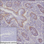 SCRIB Recombinant Mouse Monoclonal Antibody (K2K018_11B1)