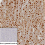 SNRNP27 Antibody in Immunohistochemistry (Paraffin) (IHC (P))