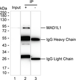MAD1 Recombinant Mouse Monoclonal Antibody (K56049_15C2)