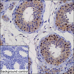 PSMC3IP Recombinant Mouse Monoclonal Antibody (K1E058_13E10)