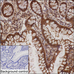 PSMA2 Recombinant Mouse Monoclonal Antibody (K94054_11C8)