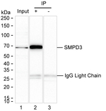 SMPD3 Antibody in Immunoprecipitation (IP)