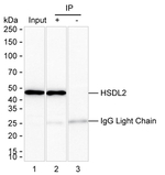 HSDL2 Antibody in Immunoprecipitation (IP)