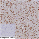 TOR1AIP1 Recombinant Mouse Monoclonal Antibody (K16316_3D5)