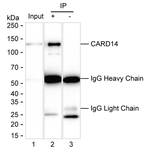 CARD14 Antibody in Immunoprecipitation (IP)