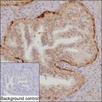 SRM Antibody in Immunohistochemistry (Paraffin) (IHC (P))
