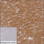 AMDHD2 Recombinant Mouse Monoclonal Antibody (K2K017_4C1)