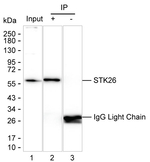 MST4 Recombinant Mouse Monoclonal Antibody (K40072_19B5)