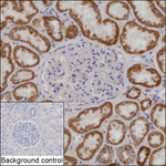 NDUFA7 Recombinant Mouse Monoclonal Antibody (K1E087_14A6)