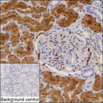 DOPA Decarboxylase Recombinant Mouse Monoclonal Antibody (K06371_6H1)