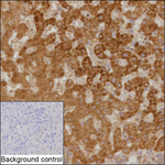 PSMB7 Recombinant Mouse Monoclonal Antibody (KCA013_19B12)