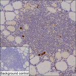 AHI1-DT Recombinant Mouse Monoclonal Antibody (K92101_8E8)