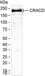 KIAA1211 Antibody in Western Blot (WB)