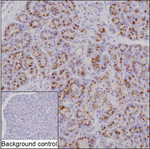 GALNT2 Recombinant Mouse Monoclonal Antibody (K9N049_16D6)
