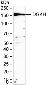 DGKH Recombinant Mouse Monoclonal Antibody (K94091_8F5)