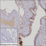 HIN-1 Recombinant Mouse Monoclonal Antibody (K29113_3A1)