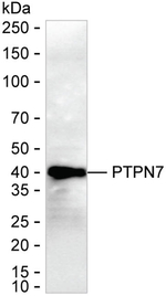 PTPN7 Recombinant Mouse Monoclonal Antibody (K94091_11D5)
