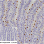 NPHP1 Recombinant Mouse Monoclonal Antibody (K8U061_15B4)