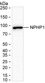 NPHP1 Antibody in Western Blot (WB)