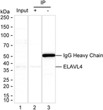 HuD Antibody in Immunoprecipitation (IP)