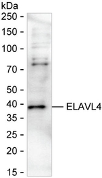 HuD Recombinant Human Monoclonal Antibody (K24037_10B1)