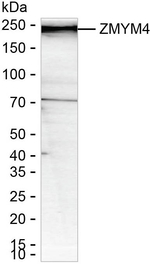ZMYM4 Recombinant Mouse Monoclonal Antibody (K40110_3B3)