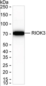 RIOK3 Recombinant Mouse Monoclonal Antibody (K40110_9A12)