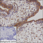 CTGF Recombinant Mouse Monoclonal Antibody (KBL014_1D11)