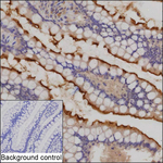 INPP1 Recombinant Mouse Monoclonal Antibody (K9N060_7B2)