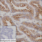 TXNDC3 Recombinant Mouse Monoclonal Antibody (K1H042_13C2)