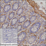 KANK2 Recombinant Mouse Monoclonal Antibody (K8U066_3C12)