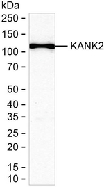 KANK2 Antibody in Western Blot (WB)