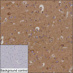 MTERFD3 Recombinant Mouse Monoclonal Antibody (K8U069_5D9)