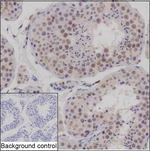 PHF10 Recombinant Mouse Monoclonal Antibody (K1H045_16E1)