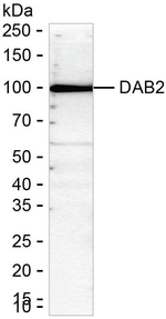 DAB2 Recombinant Mouse Monoclonal Antibody (K9N069_16G1)