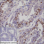 KIFC1 Recombinant Mouse Monoclonal Antibody (K29123_19B2)