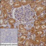 C1orf50 Recombinant Mouse Monoclonal Antibody (K24094_6B10)