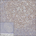 IKZF3 Recombinant Mouse Monoclonal Antibody (K92116_15B7)