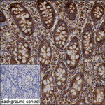 HSPE1 Recombinant Mouse Monoclonal Antibody (KBL017_4A2)