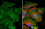 PD-L1 Recombinant Rabbit Monoclonal Antibody (HL1041)