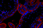 PD-L1 Antibody in Immunohistochemistry (Paraffin) (IHC (P))