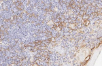 PD-L1 Antibody in Immunohistochemistry (Paraffin) (IHC (P))